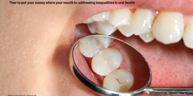 Economist Impact white paper on caries and periodontitis