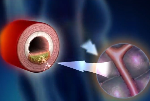 perio and cardio image