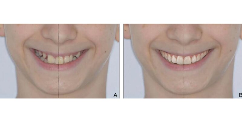 clinical photographs