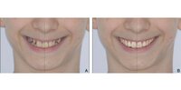 clinical photographs