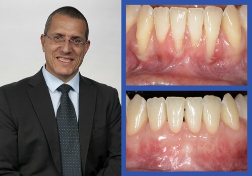 Anton Sculean provides 'inspirational' start for EFP Perio Sessions live webinars