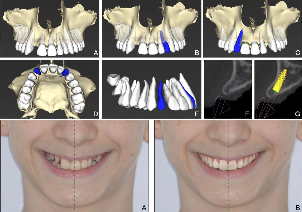 graphics and photos illustrating dental treatment