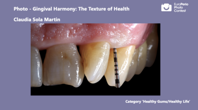 "Healthy Gums, Healthy Life" first prize Teeth