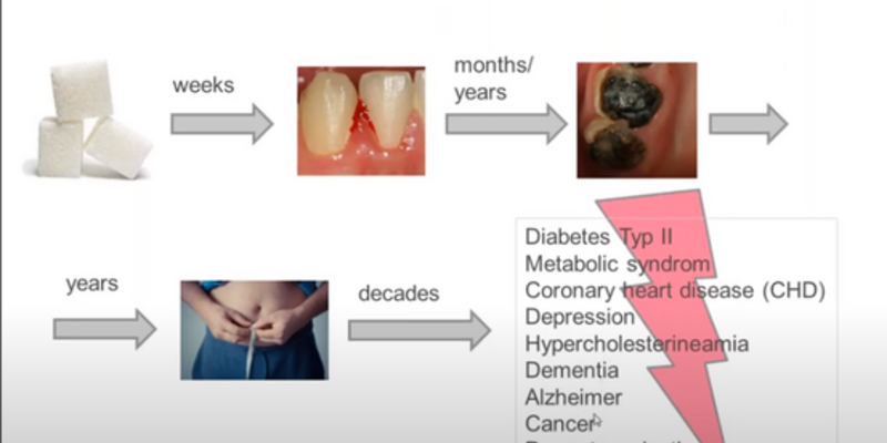 Latest EFP Perio Sessions webinars put focus on use of L-PRF and on role of diet in prevention and treatment of periodontal diseases
