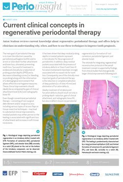 Latest issue of Perio Insight features Anton Sculean on regenerative periodontal therapy and Søren Jepsen on EuroPerio9 scientific programme