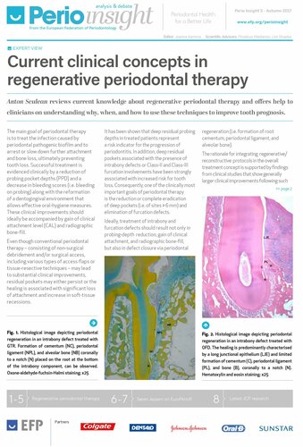 Latest issue of Perio Insight features Anton Sculean on regenerative periodontal therapy and Søren Jepsen on EuroPerio9 scientific programme