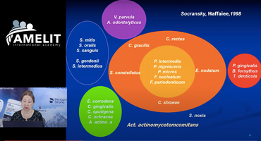 Response to Covid-19: Ukrainian perio society organises multiple webinars