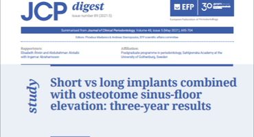 Short implants ‘less predictable’ than long implants combined with OSFE