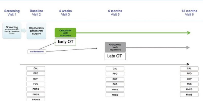 Latest JCP Digest explores timing of orthodontic therapy in patients with stage IV periodontitis