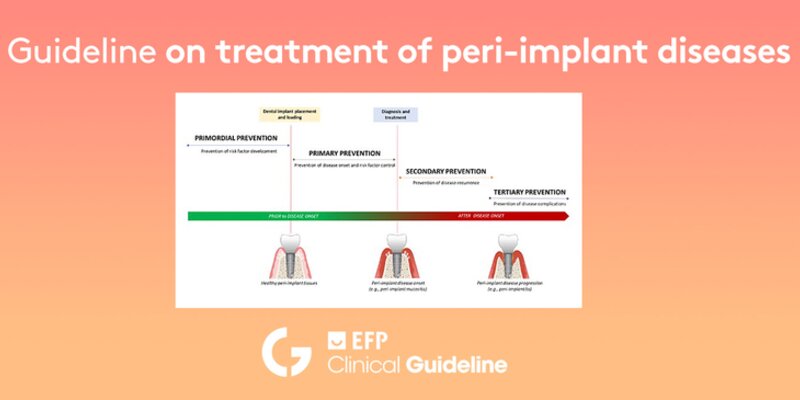 Guideline on the prevention and treatment of peri-implant diseases