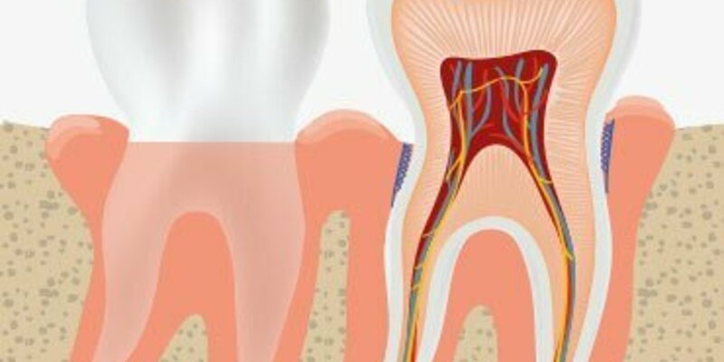 Gum disease - what it is, how it evolves