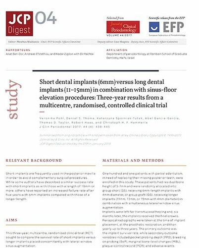 Short or long dental implants? JCP Digest weighs up the evidence