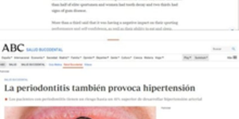 EuroPerio9 has had a massive media impact