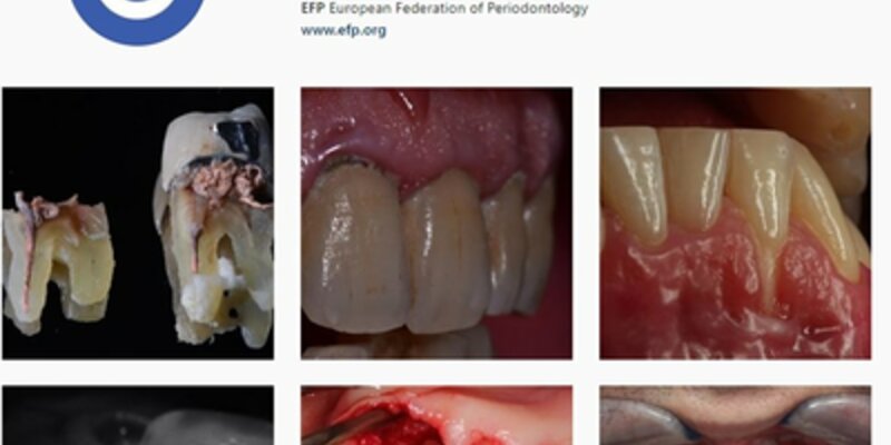 EFP photo competition, with prizes to be awarded at EuroPerio9, attracts wide participation