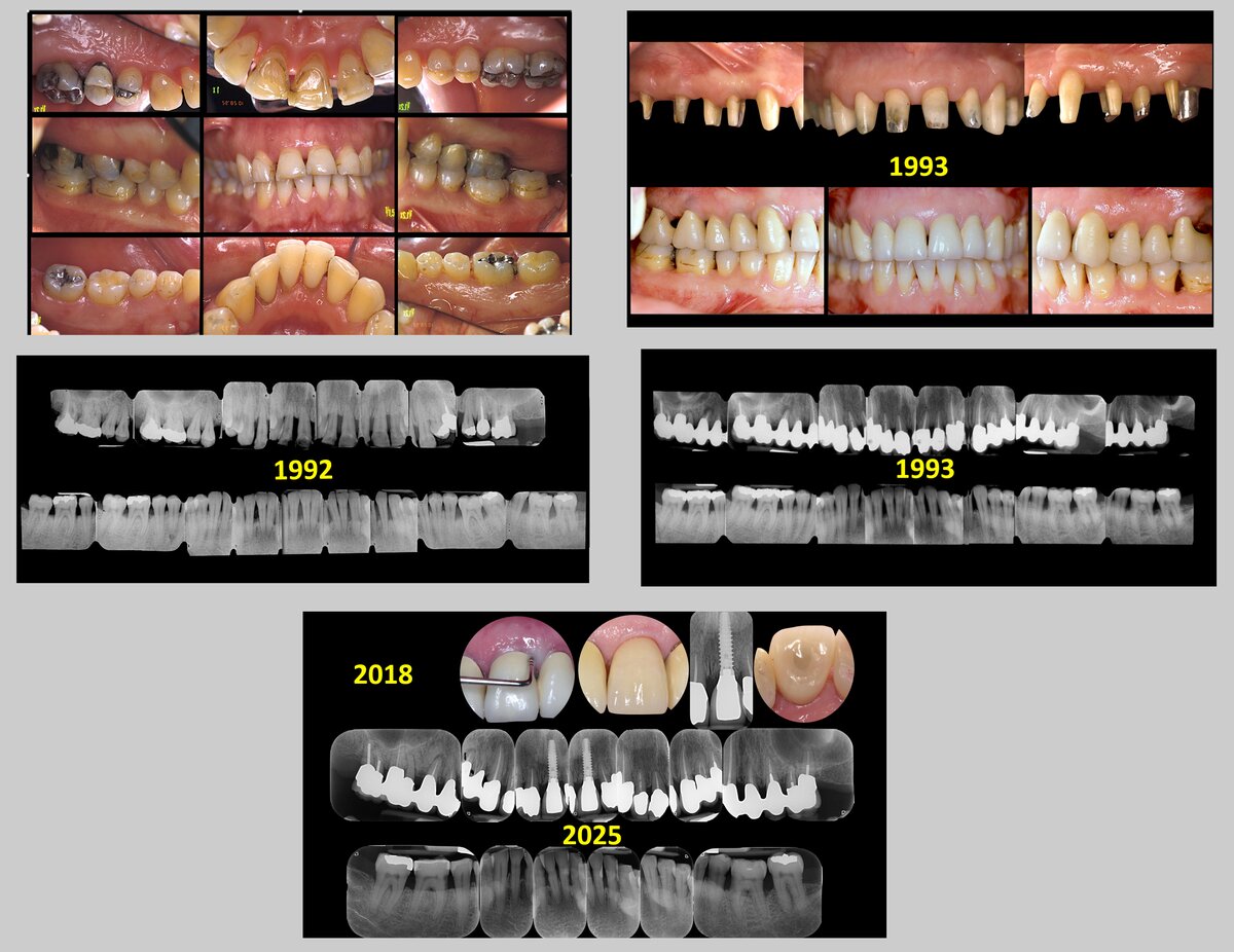 clinical and radiographical images