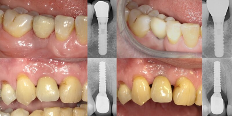 clinical photo