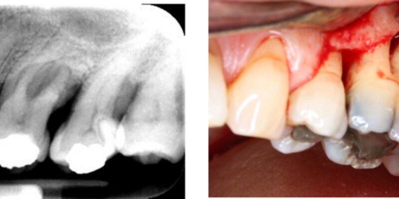 radiographic and clinical photos