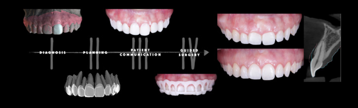 graphic illustrating perio-restorative interplay
