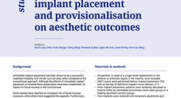 Immediate provisional implants ‘do not increase aesthetic outcome’