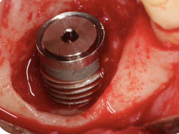 Clinical image showing defect