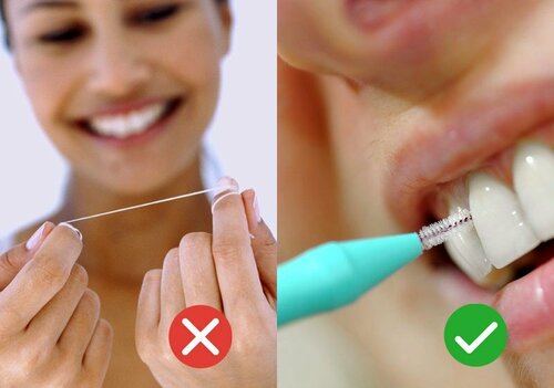 EFP provides clear guidance to public on interdental cleaning in response to media controversy about flossing