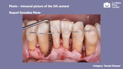 First prize "Dental disease" category Teeth