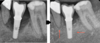 Clinical image