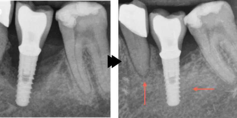 Clinical image