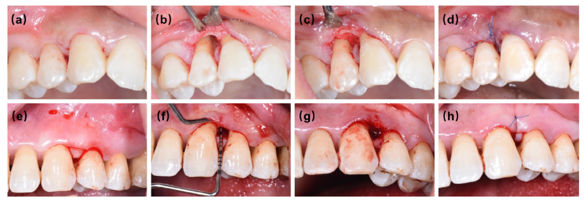 clinical photograph