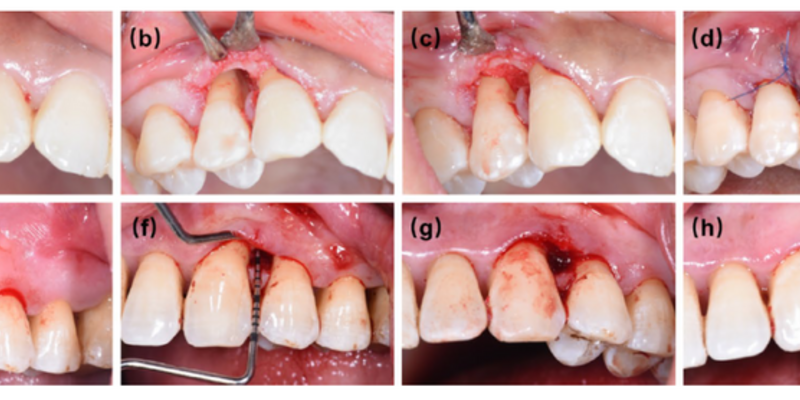 clinical photograph