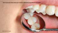 Economist Impact white paper on caries and periodontitis