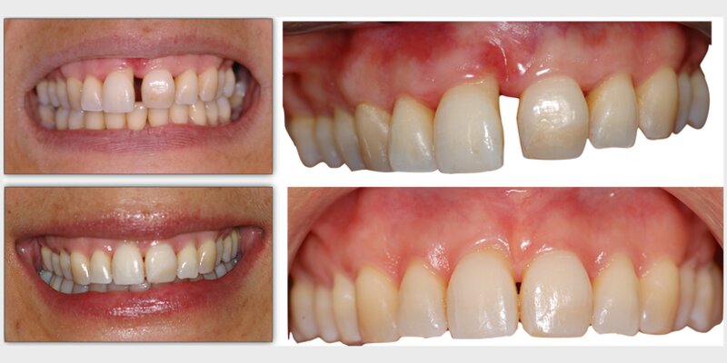 clinical photographs