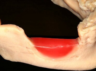 Novel concepts in regeneration will be key topic at Dublin master clinic