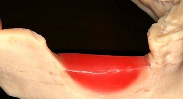 Novel concepts in regeneration will be key topic at Dublin master clinic