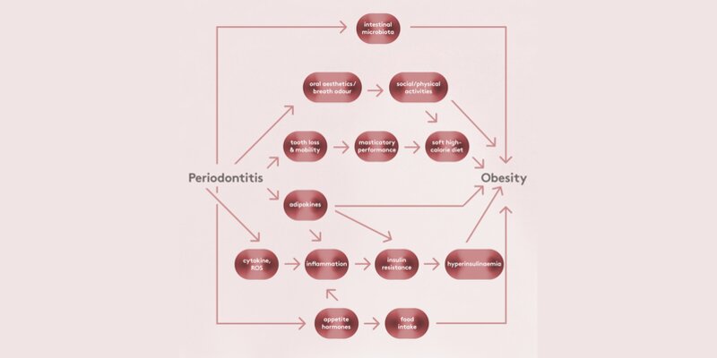 graphic illustrating periodontitis-obesity relationship