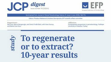 Periodontal regeneration can be ‘first choice of treatment’ in severe cases