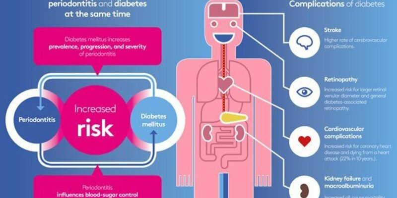 People with periodontitis are likely to develop diabetes mellitus – and vice versa