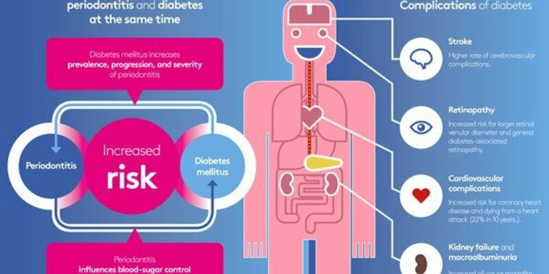 People with periodontitis are likely to develop diabetes mellitus – and vice versa