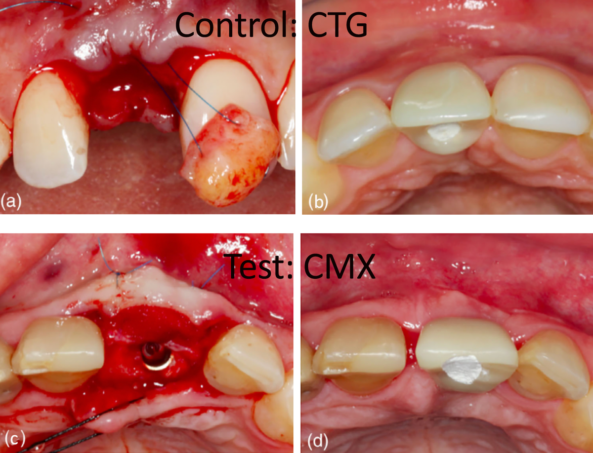 series of clinical photographs