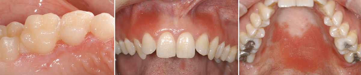 clinical images