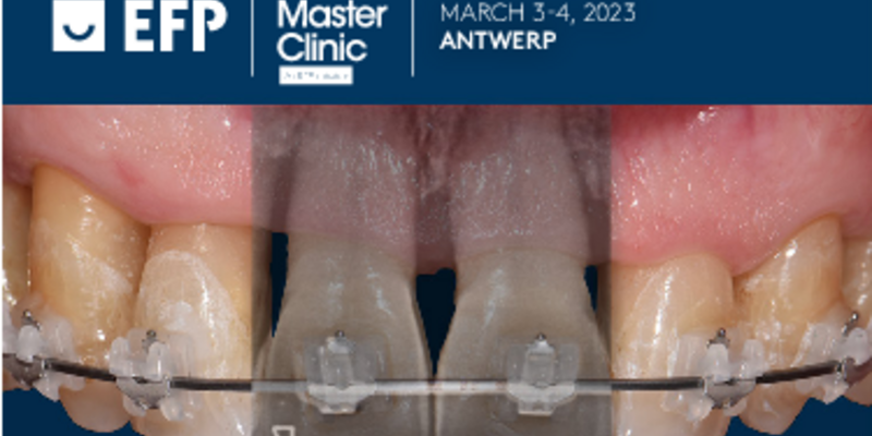 The challenge of missing teeth and facial growth – under the spotlight at Perio Master Clinic 2023