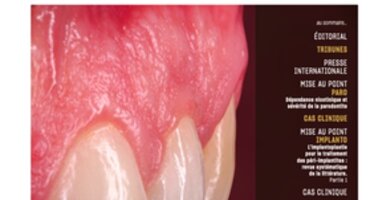 French perio society backs new magazine for general dentists