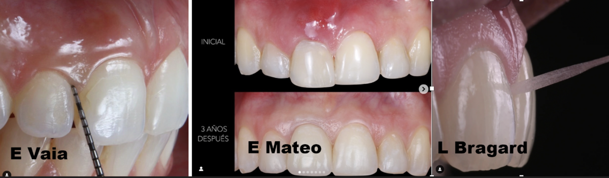 Healthy gums look good on you