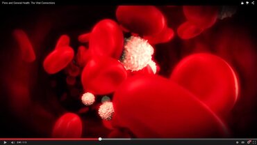 EFP video explores links and 'vital connections' between perio and general health