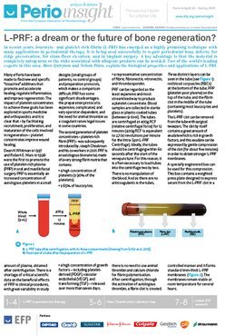 Perio Insight focuses on L-PRF in periodontal therapy