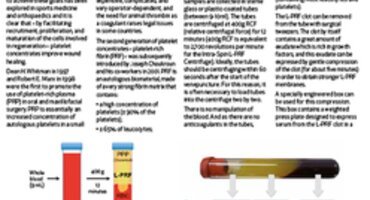 Perio Insight focuses on L-PRF in periodontal therapy