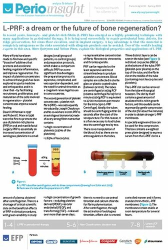 Perio Insight focuses on L-PRF in periodontal therapy