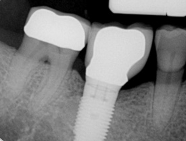 Radiographic image