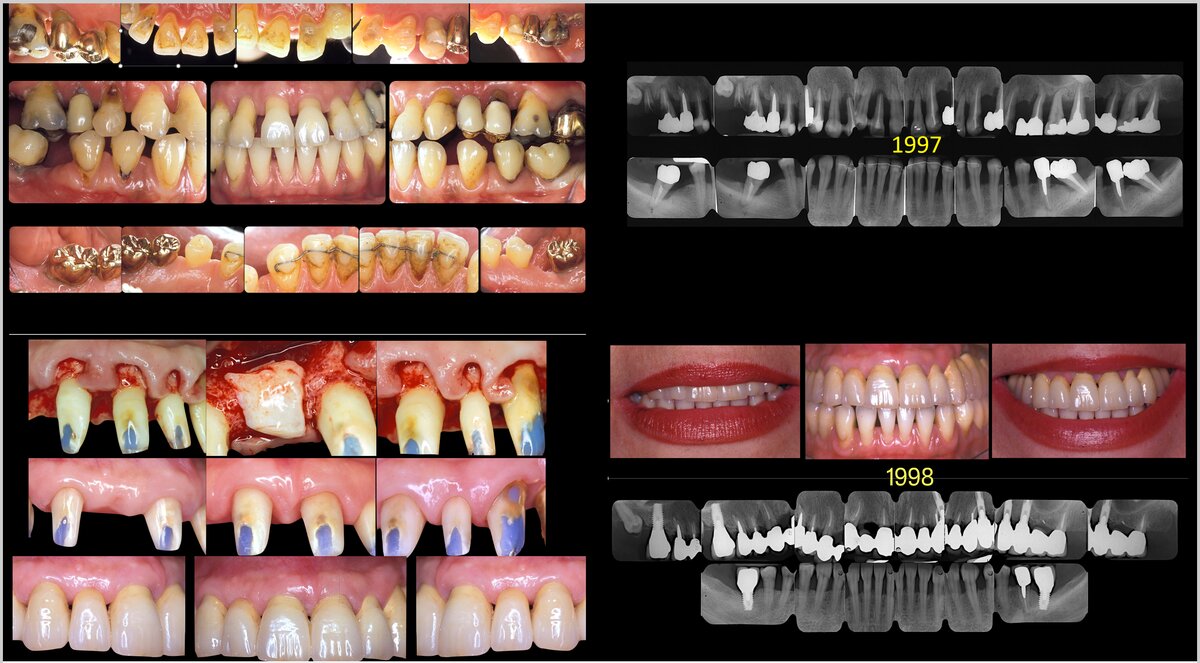 Clinical and radiographical images