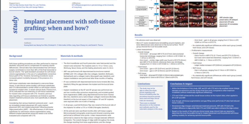 JCP Digest 100: When and how should implants be placed with soft-tissue grafting?